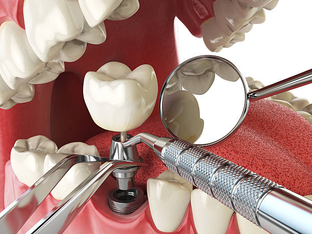 Best Weekend Emergency Dentist in West Lafayette, OH